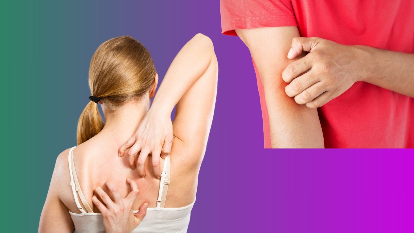 What Is Causing Your Itchy Rash DermOnDemand