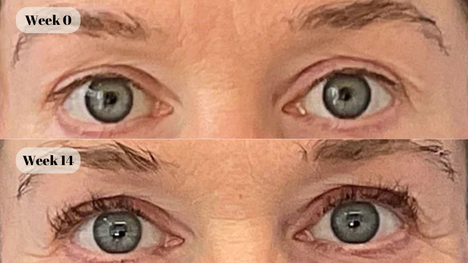 latisse before and after (4)