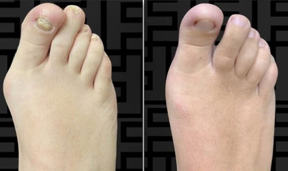 footr-before-after-4