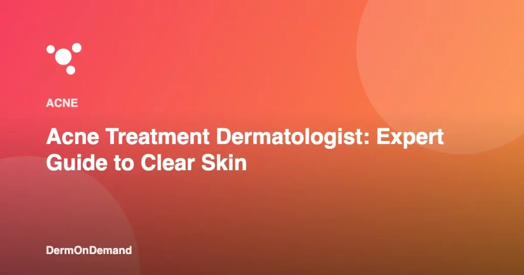 Acne Treatment Dermatologist Expert Guide to Clear Skin - DermOnDemand dermatology guide illustration covering acne, treatments