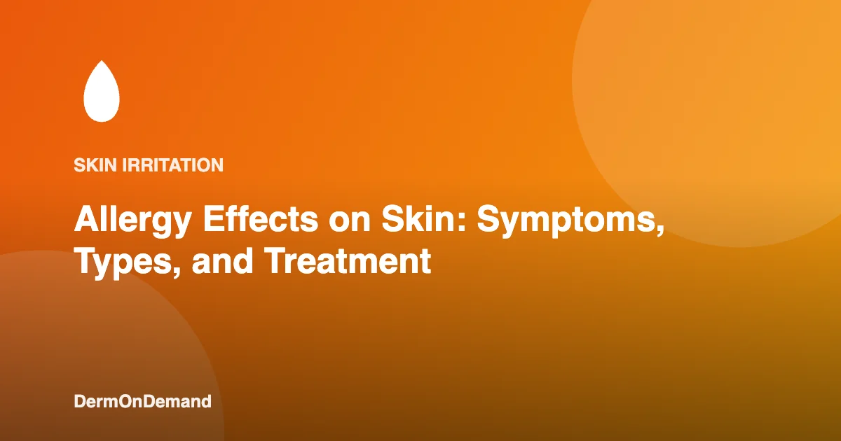 Allergy Effects on Skin Symptoms, Types, and Treatment - DermOnDemand dermatology guide illustration covering skin conditions