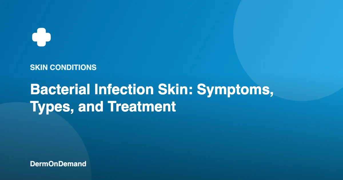 Bacterial Infection Skin Symptoms, Types, and Treatment - DermOnDemand dermatology guide illustration covering skin conditions, treatments