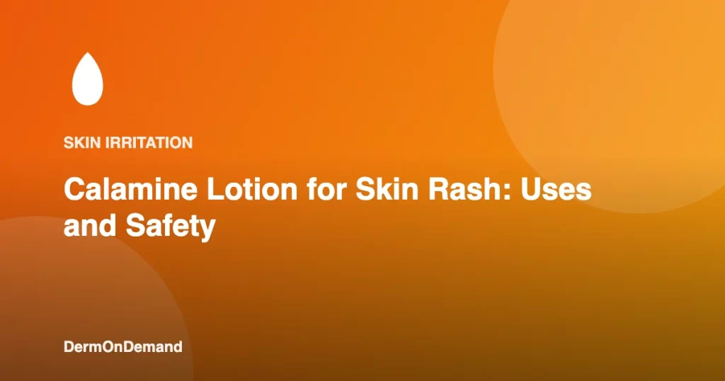 Calamine Lotion for Skin Rash Uses and Safety - DermOnDemand dermatology guide illustration covering treatments
