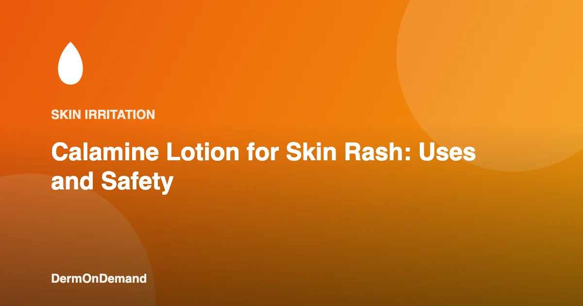 Calamine Lotion for Skin Rash Uses and Safety - DermOnDemand dermatology guide illustration covering treatments