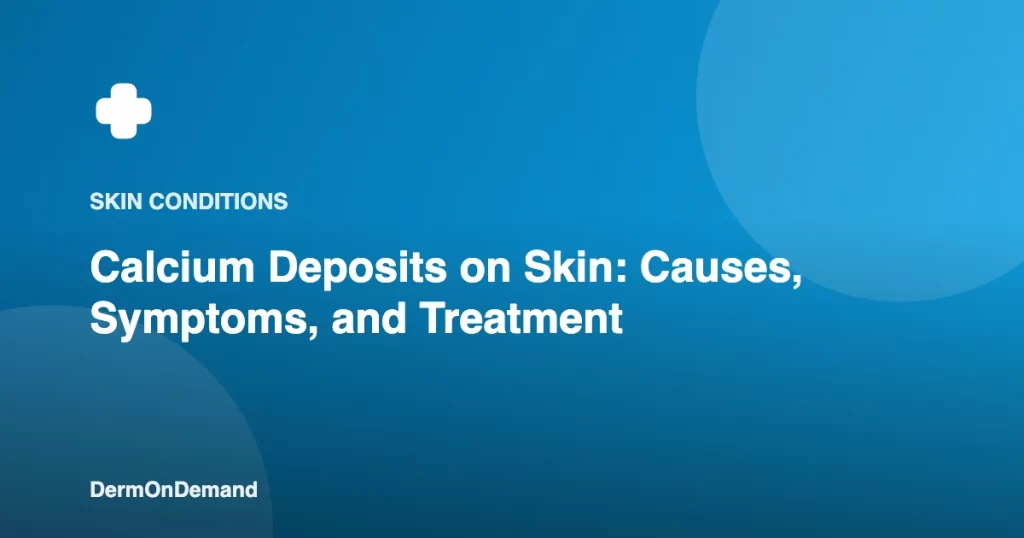 Calcium Deposits on Skin Causes, Symptoms, and Treatment - DermOnDemand dermatology guide illustration covering skin conditions