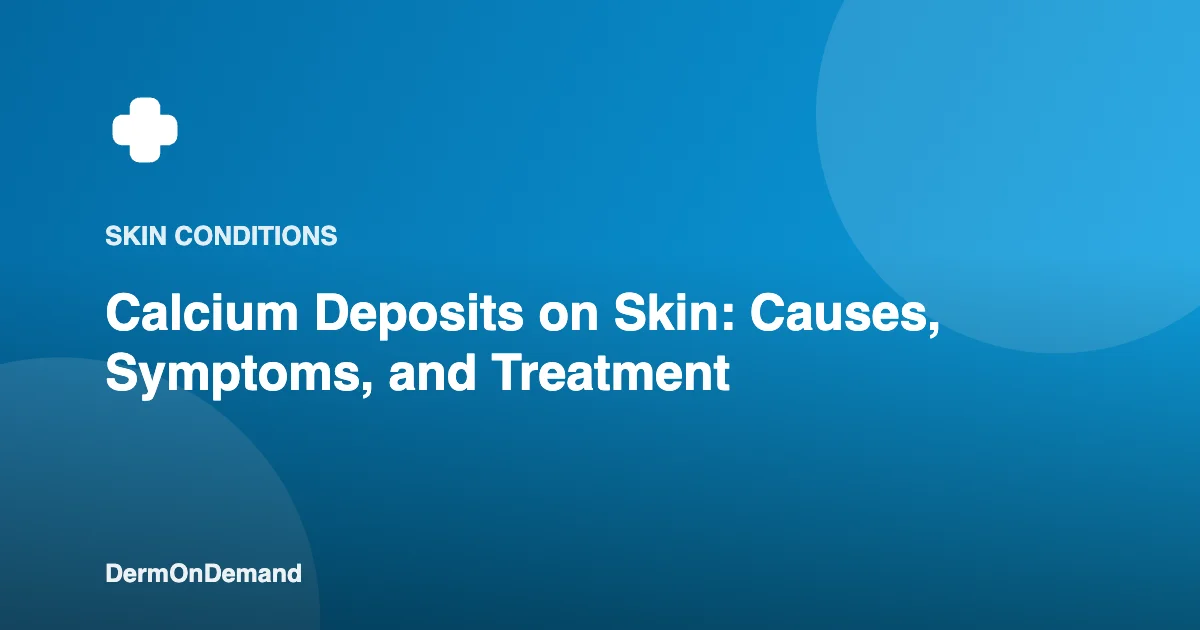 Calcium Deposits on Skin Causes, Symptoms, and Treatment - DermOnDemand dermatology guide illustration covering skin conditions