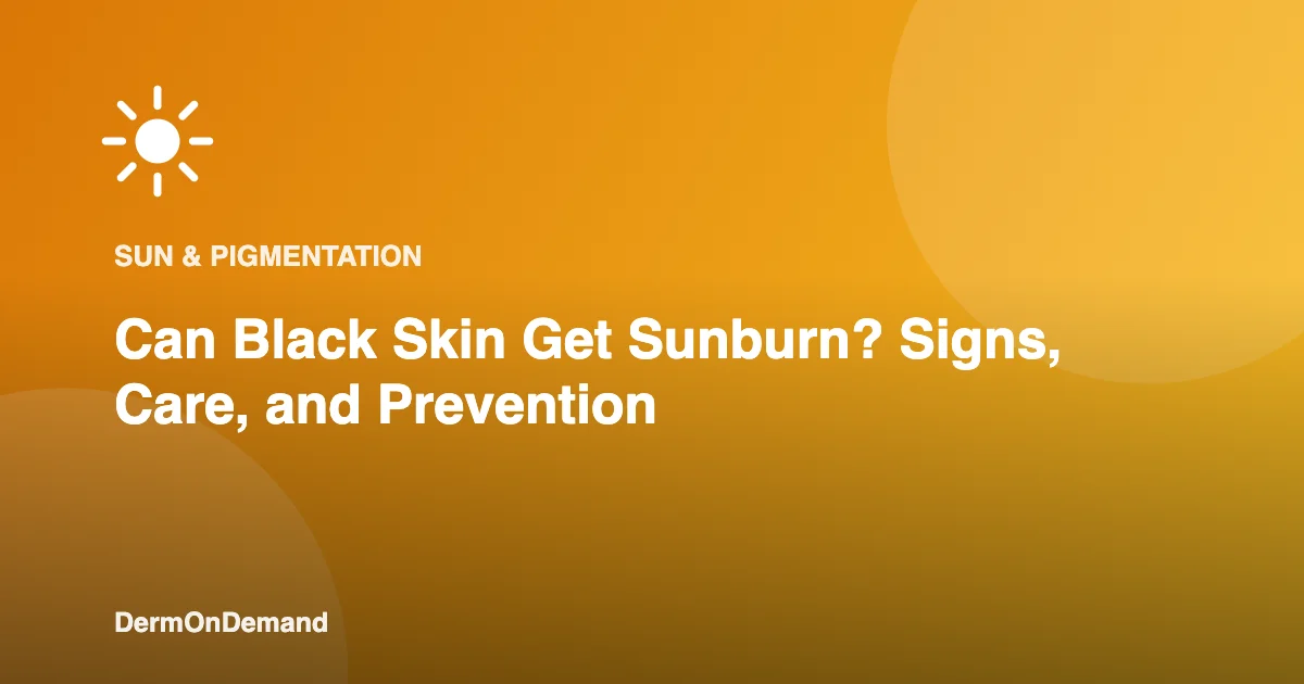 Can Black Skin Get Sunburn Signs, Care, and Prevention - DermOnDemand dermatology guide illustration covering blog, skin conditions