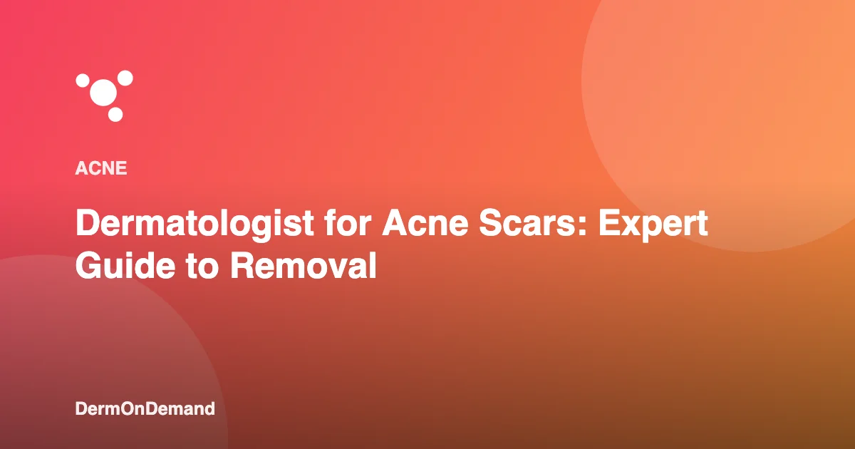 Dermatologist for Acne Scars Expert Guide to Removal - DermOnDemand dermatology guide illustration covering acne, treatments