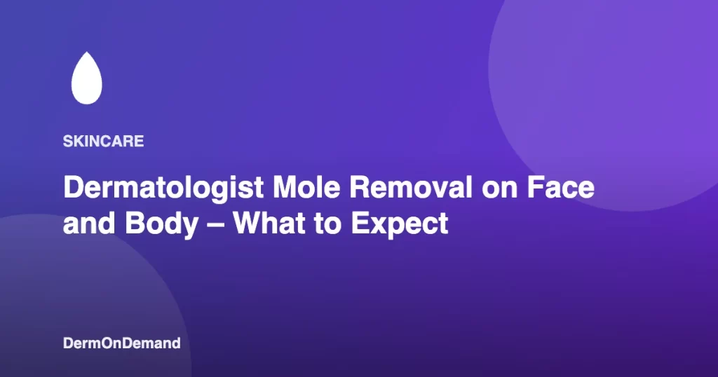 Dermatologist Mole Removal on Face and Body – What to Expect - DermOnDemand dermatology guide illustration covering blog, dermondemand