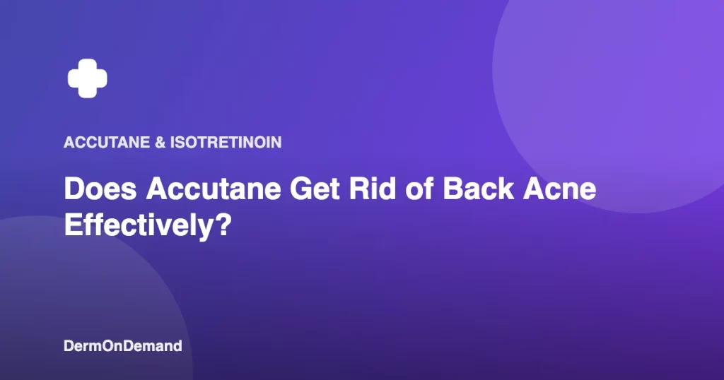 Does Accutane Get Rid of Back Acne Effectively - DermOnDemand dermatology guide illustration covering blog