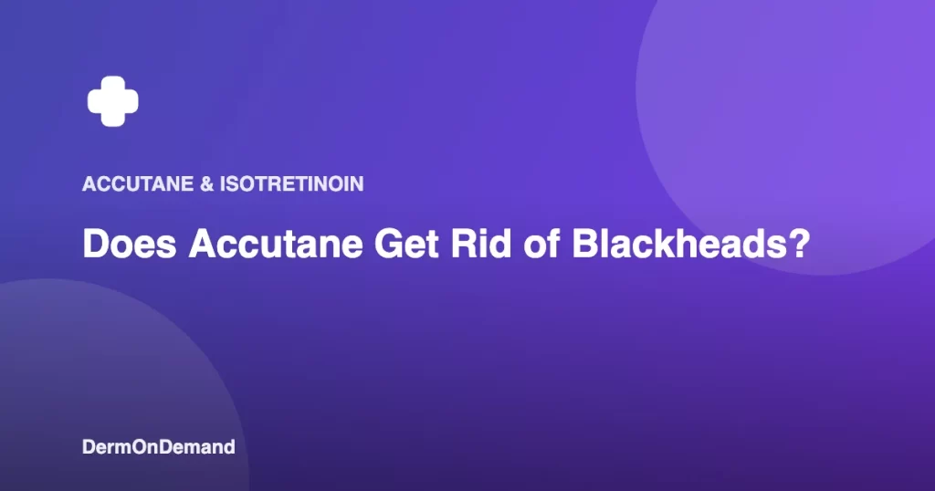 Does Accutane Get Rid of Blackheads - DermOnDemand dermatology guide illustration covering accutane, skin conditions