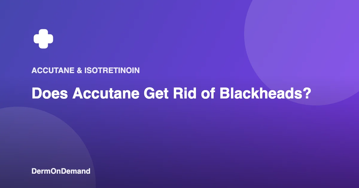 Does Accutane Get Rid of Blackheads - DermOnDemand dermatology guide illustration covering accutane, skin conditions