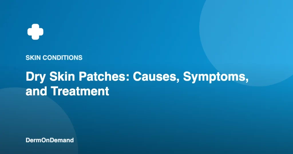 Dry Skin Patches Causes, Symptoms, and Treatment - DermOnDemand dermatology guide illustration covering skin conditions