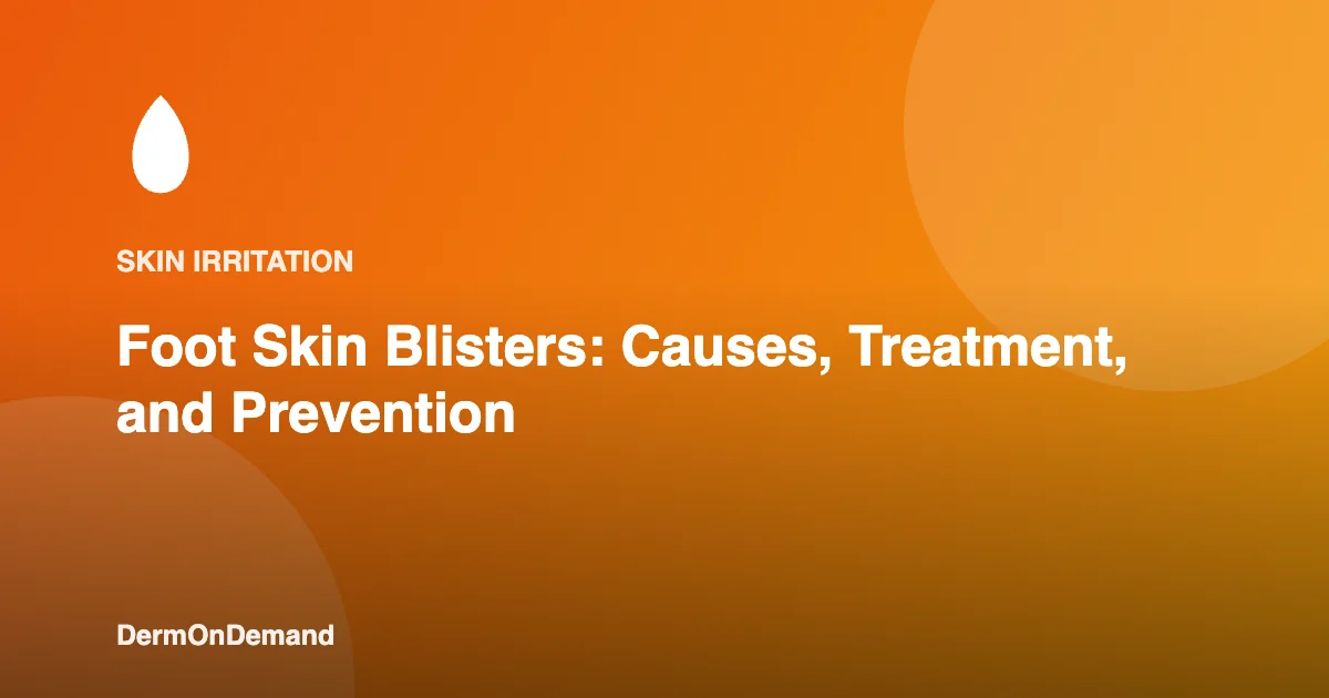 Foot Skin Blisters Causes, Treatment, and Prevention - DermOnDemand dermatology guide illustration covering blog, skin conditions