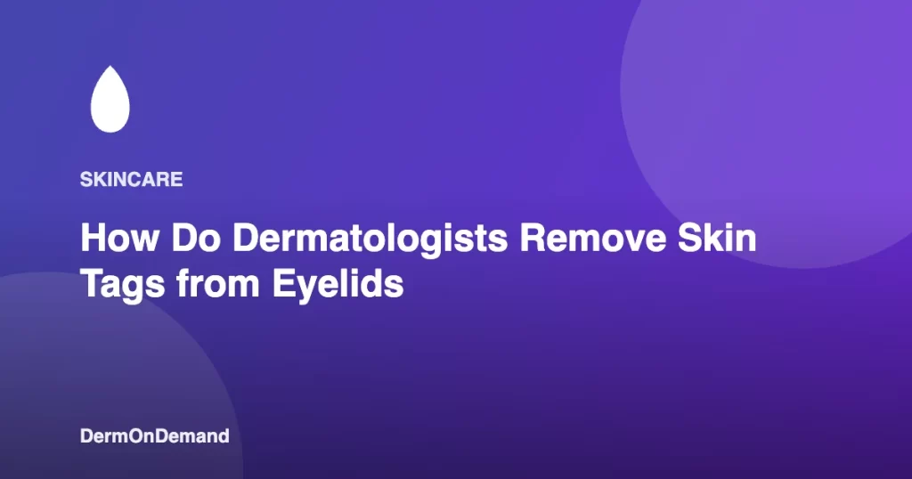 How Do Dermatologists Remove Skin Tags from Eyelids - DermOnDemand dermatology guide illustration covering blog, dermondemand