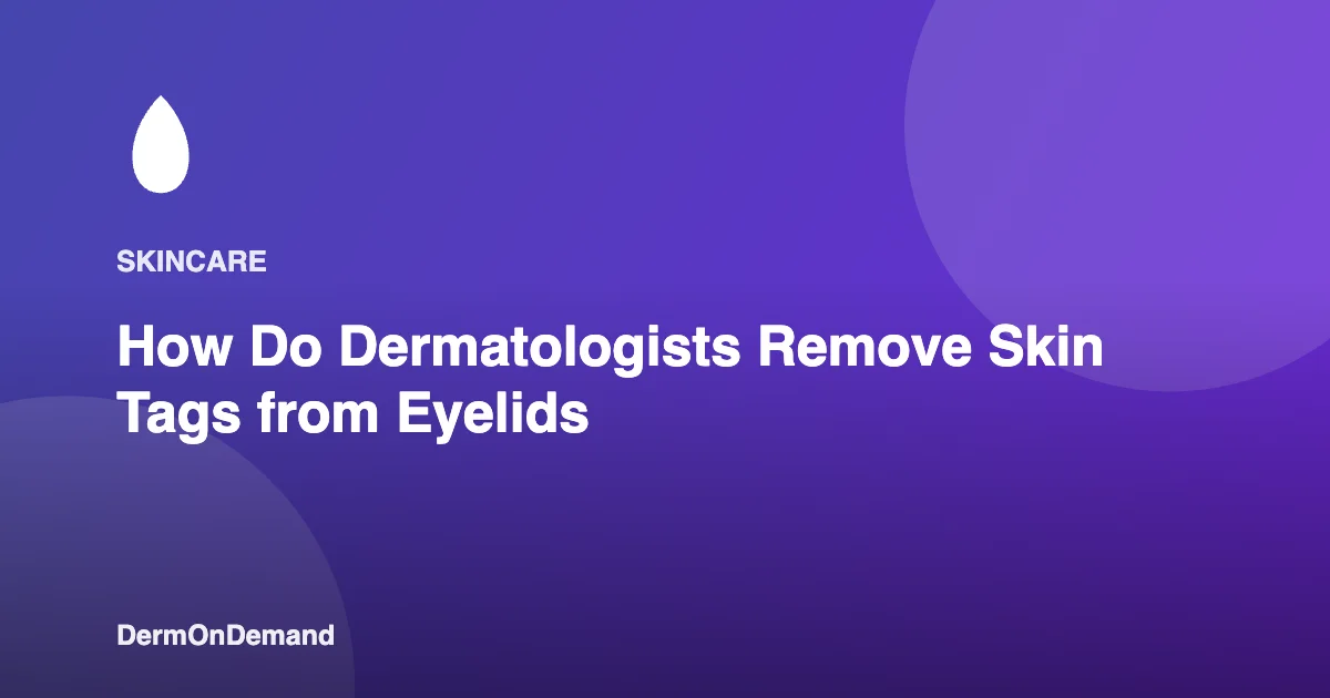 How Do Dermatologists Remove Skin Tags from Eyelids - DermOnDemand dermatology guide illustration covering blog, dermondemand