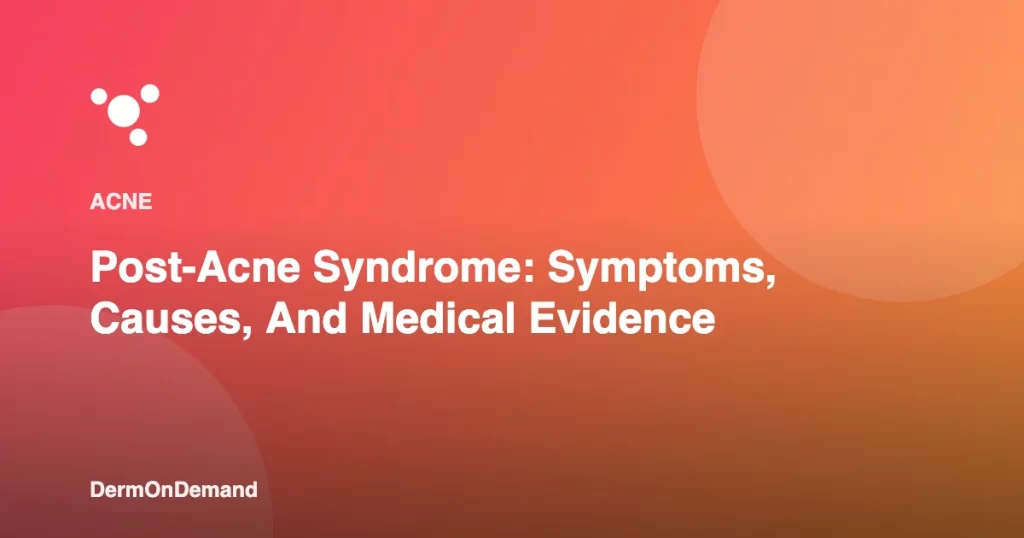 Post-Acne Syndrome Symptoms, Causes, And Medical Evidence - DermOnDemand dermatology guide illustration covering blog