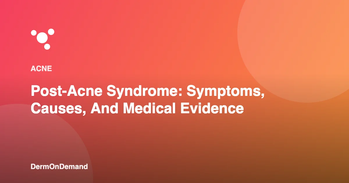 Post-Acne Syndrome Symptoms, Causes, And Medical Evidence - DermOnDemand dermatology guide illustration covering blog