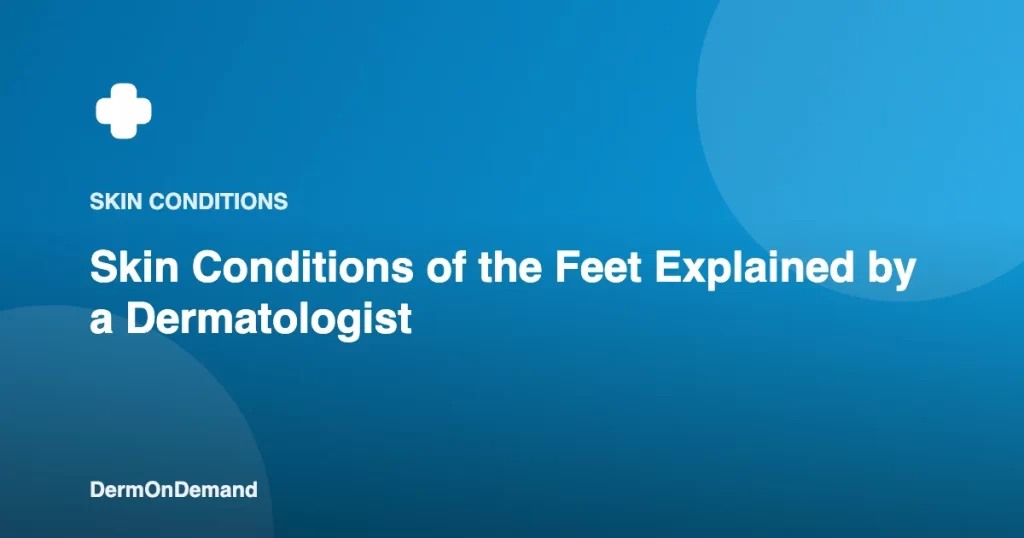Skin Conditions of the Feet Explained by a Dermatologist - DermOnDemand dermatology guide illustration covering blog, treatments