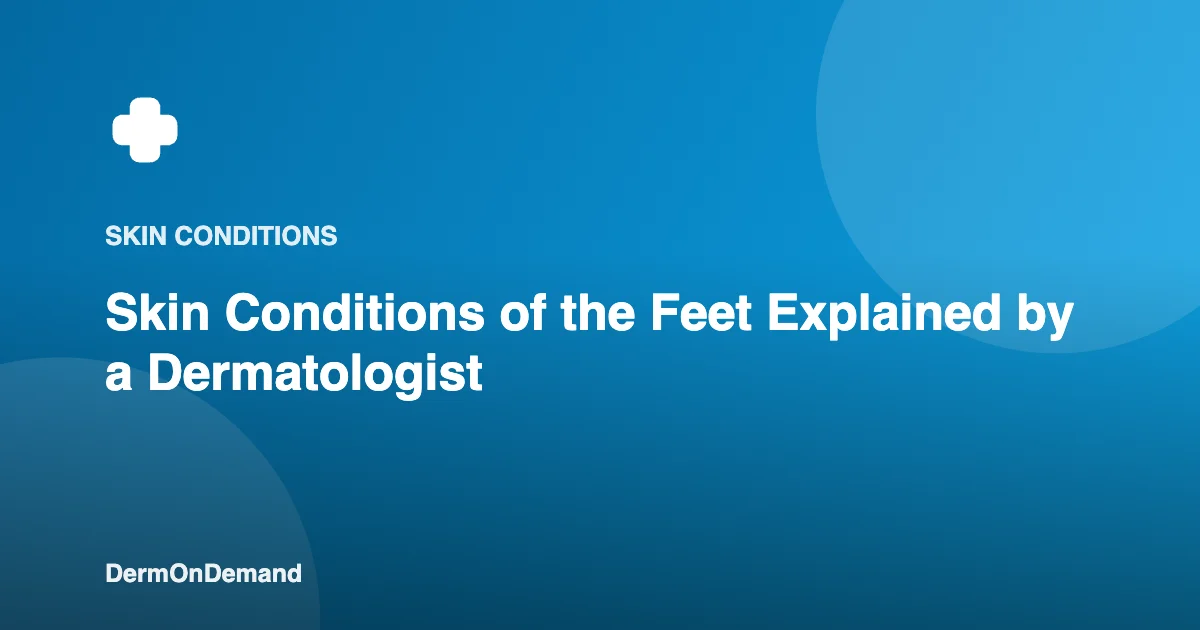 Skin Conditions of the Feet Explained by a Dermatologist - DermOnDemand dermatology guide illustration covering blog, treatments