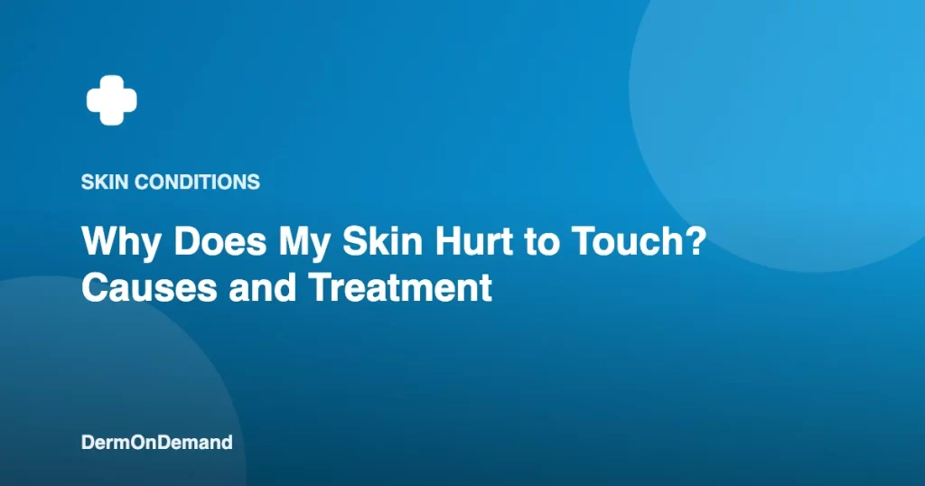 Why Does My Skin Hurt to Touch Causes and Treatment - DermOnDemand dermatology guide illustration covering skin conditions