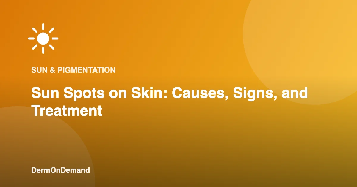 Sun Spots on Skin Causes, Signs, and Treatment - DermOnDemand dermatology guide illustration covering skin conditions